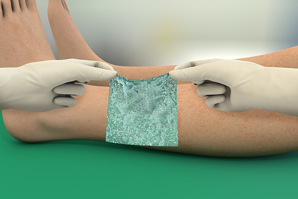 Two illustrated hands putting on Sorbact gel dressing on a leg.