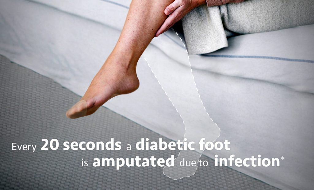 A woman sitting on a bed with one leg as a faded illustrated silhouette. With the text: Every 20 seconds a diabetic foot is amputated due to infection*